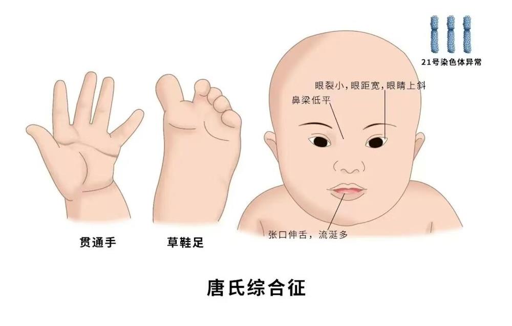 cf7db3bfe0d84eb38ba8b03c8d40db01.jpg